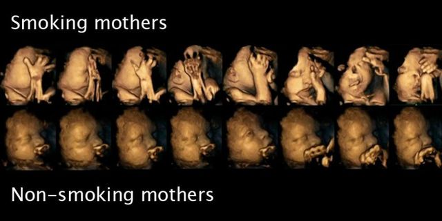 4d images from Durham university show babies of smoking and non-smoking mothers
