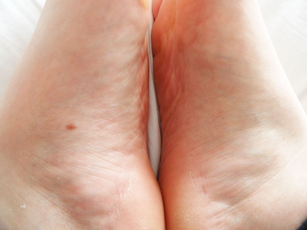 Skin, Joint, Toe, Organ, Muscle, Barefoot, Foot, Close-up, Flesh, Ankle, 