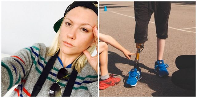 Lauren Wasser suing Kotex tampons after she loses leg