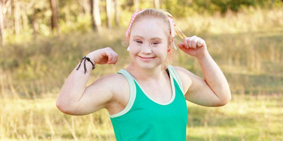 Madeline Stuart A Model With Downs Syndrome Lands A Modelling