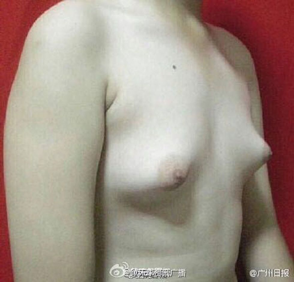 Man's boobs after eating fried chicken