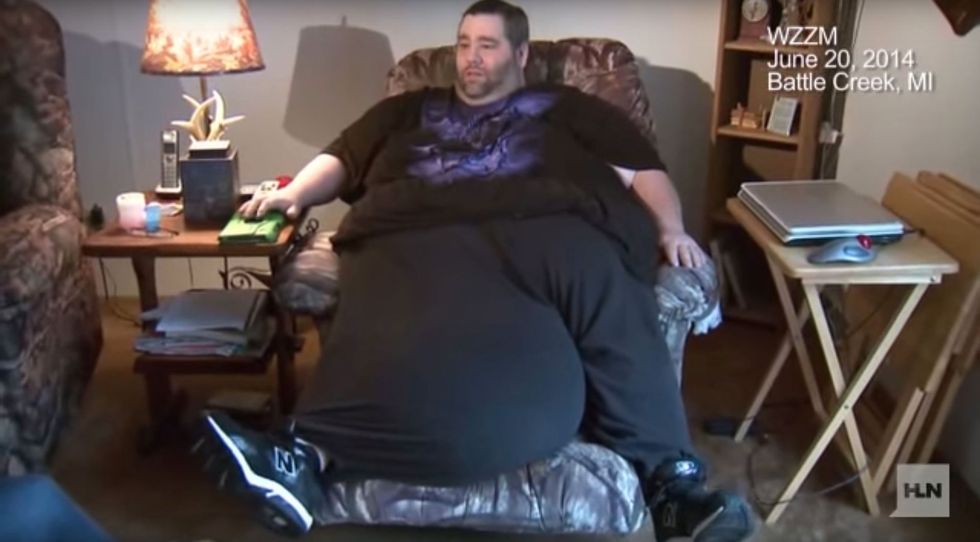 Man with the 5 stone scrotum finally gets it removed and is loving life