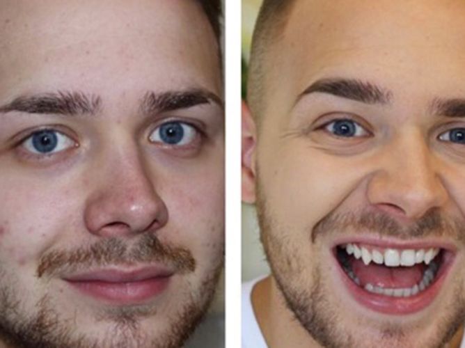 man with makeup before and after