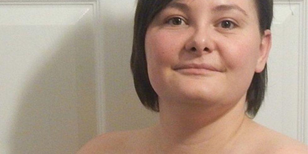 Woman Shares Raw Double Mastectomy Photos To Show Scars Are Nothing To