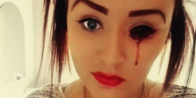 17-year-old Marnie-Rae girl bleeds from her eyes and nobody knows why