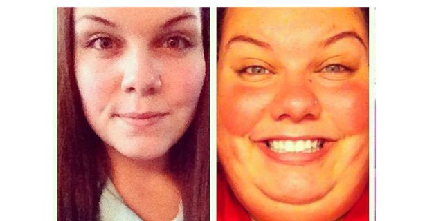 Woman shares photos of weight loss