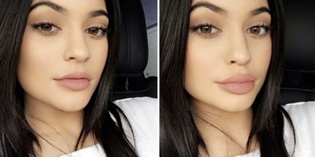 Kylie Jenner demoes her latest lip-pluming trick