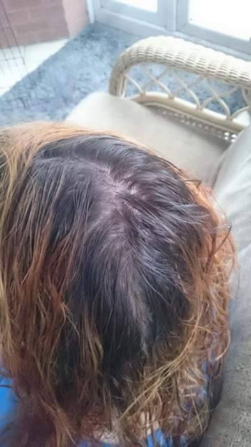 Girl ends up with black hair after buying blonde hair dye