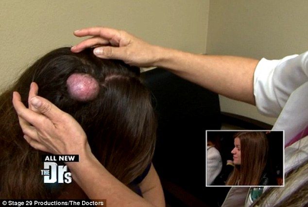 The Doctors rate worst ever spot squeezing videos