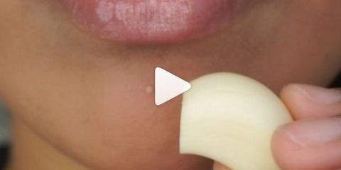 Why are women rubbing garlic on their faces? Why are women rubbing garlic on their faces?