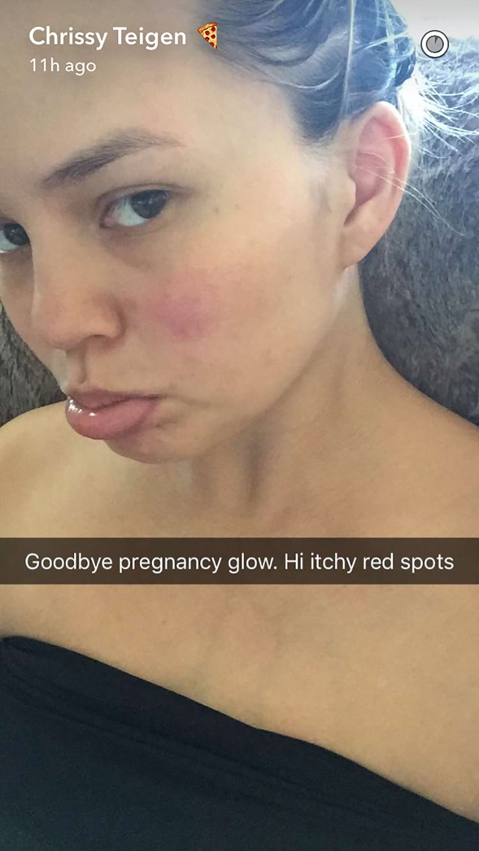 Chrissy Teigen post-pregnancy skin Snapchat