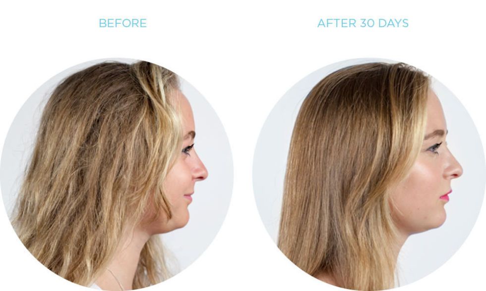 ice cold hair straightener