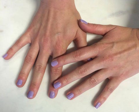 Can hypnotherapy really stop you biting your nails?