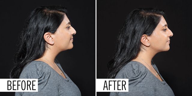 Contouring your jawline - before and after