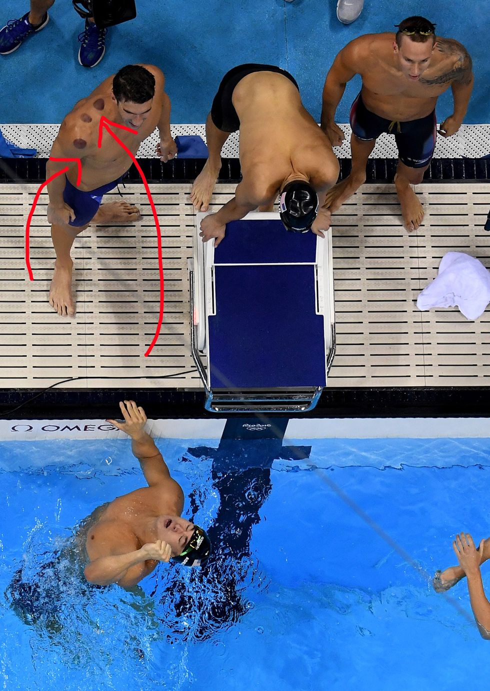 Here's why so many Olympic athletes have little red marks on them