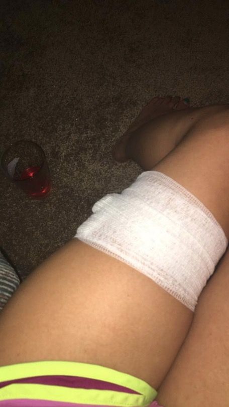 This woman was stabbed in the leg after she ignored the catcaller who told her she had nice legs
