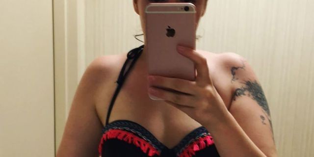 Lena Dunham shares pictures of her endometriosis scars