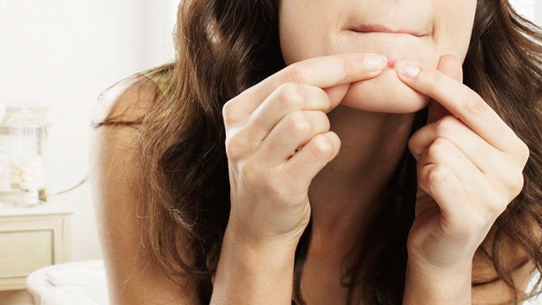 Why squeezing spots could be a lot more dangerous for your health than you think
