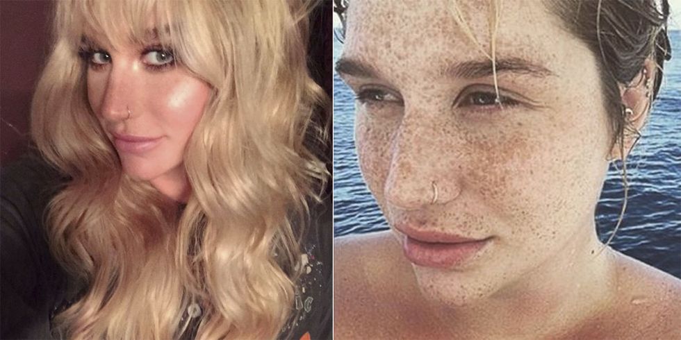 Kesha posts a no makeup selfie on instagram