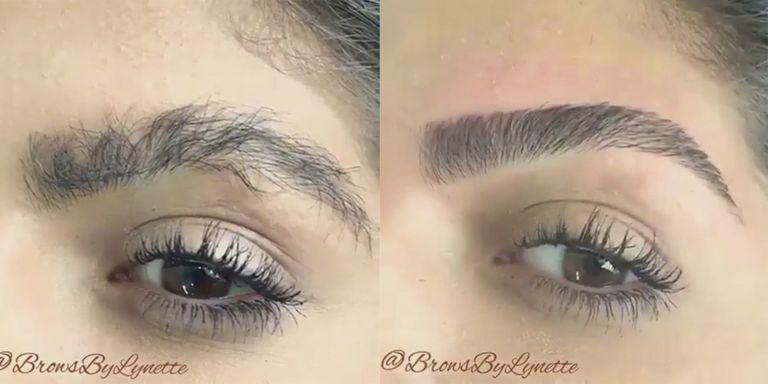Eyebrow transformations