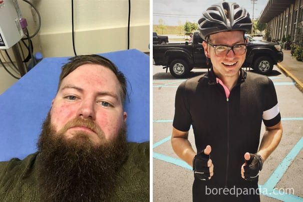 These before and after pictures of people who stopped drinking will make you want to do the same