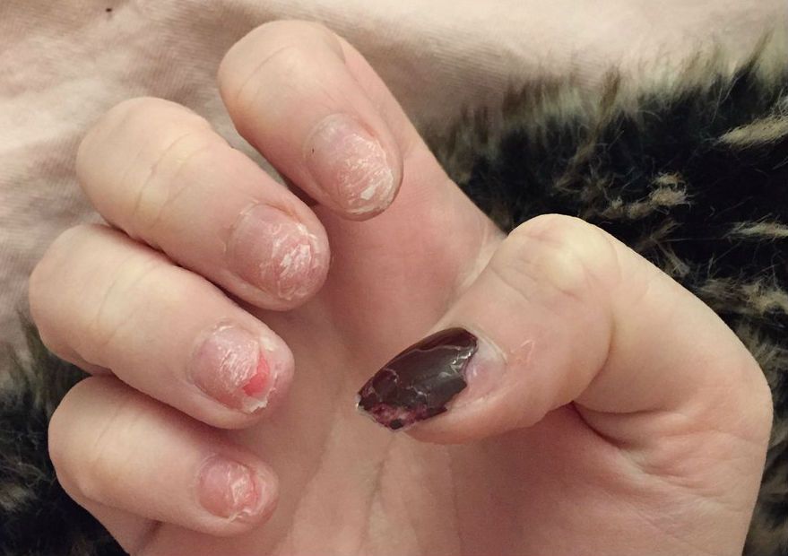 This girl has shared the reality of an acrylic nail addiction