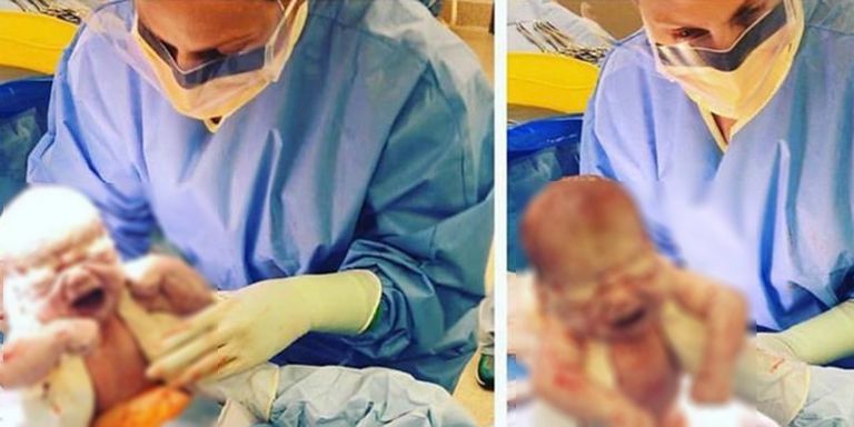 This mum delivered her own baby via C-Section and the photos are incredible