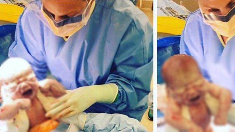 This mum delivered her own baby via C-Section and the photos are incredible