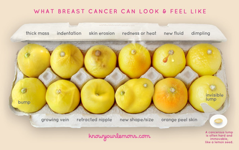 This photo could help you spot the symptoms of breast cancer