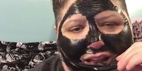 Ontcijferen Gasvormig genetisch Dangers of peel off charcoal blackhead face mask