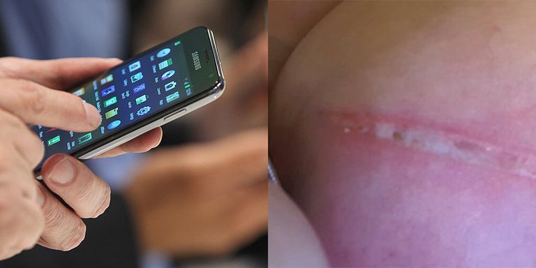 Woman proves why you should never keep your mobile phone in your bra