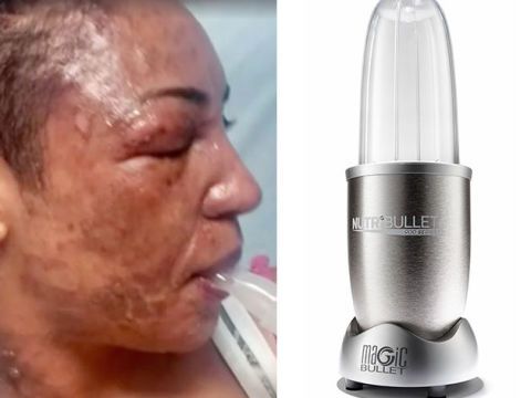 NutriBullets exploding and causing severe injuries to customers