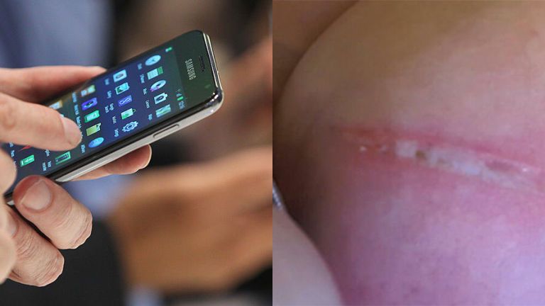 Woman proves why you should never keep your mobile phone in your bra