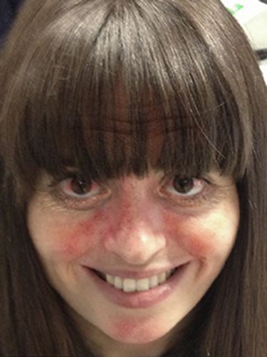 App shows how alcohol ruins skin :: Health news App shows how alcohol ruins skin :: Health news
