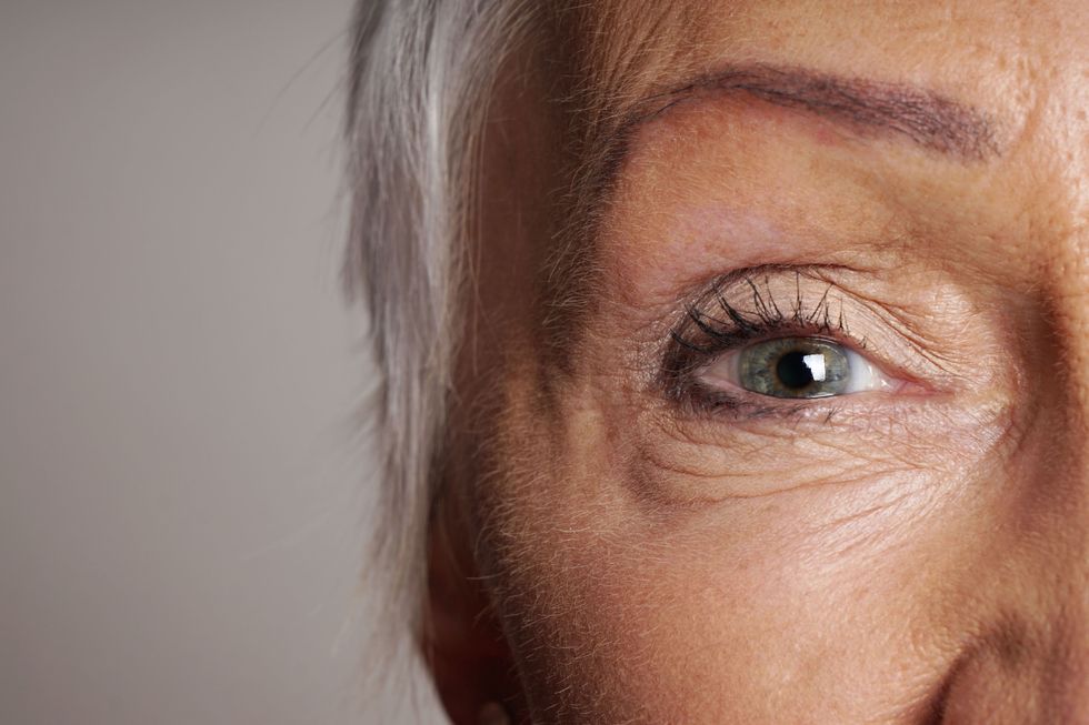 <p>Have you ever had an eye twitch? The often temporary condition can be annoying and worrisome, and for some, can be triggered by stress. </p><p>'This condition is known as <em data-redactor-tag="em">blepharospasm</em> (not to be confused with Benign Essential Blepharospasm 
–<span class="redactor-invisible-space">&nbsp;</span>a form of dystonia),'&nbsp;explains Debbie Mandel, MA, a stress and wellness expert and author of <em data-redactor-tag="em">Addicted to Stress: A Woman's 7-Step Program to Reclaim Joy and Spontaneity in Life</em>. 'Closing your eyes and visualising your happiest place on earth will help.'</p><p>Also, avoid stress-related eye issues by giving your peepers a break now and then. 'If your eyes get stressed from detailed work at the computer, "stretch" them every 20 minutes by looking out the window at a larger landscape,' suggests Mandel. 'If you have no view, close your eyes and imagine a panorama.'&nbsp;</p>