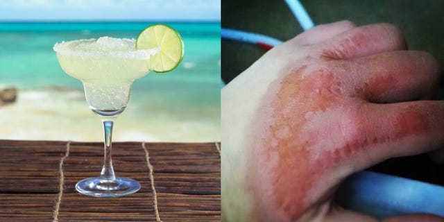 Fluid, Liquid, Glass, Skin, Lemon, Drinkware, Citrus, Drink, Tableware, Cocktail, 