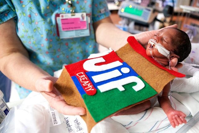 Joint, Wrist, Elbow, Service, 