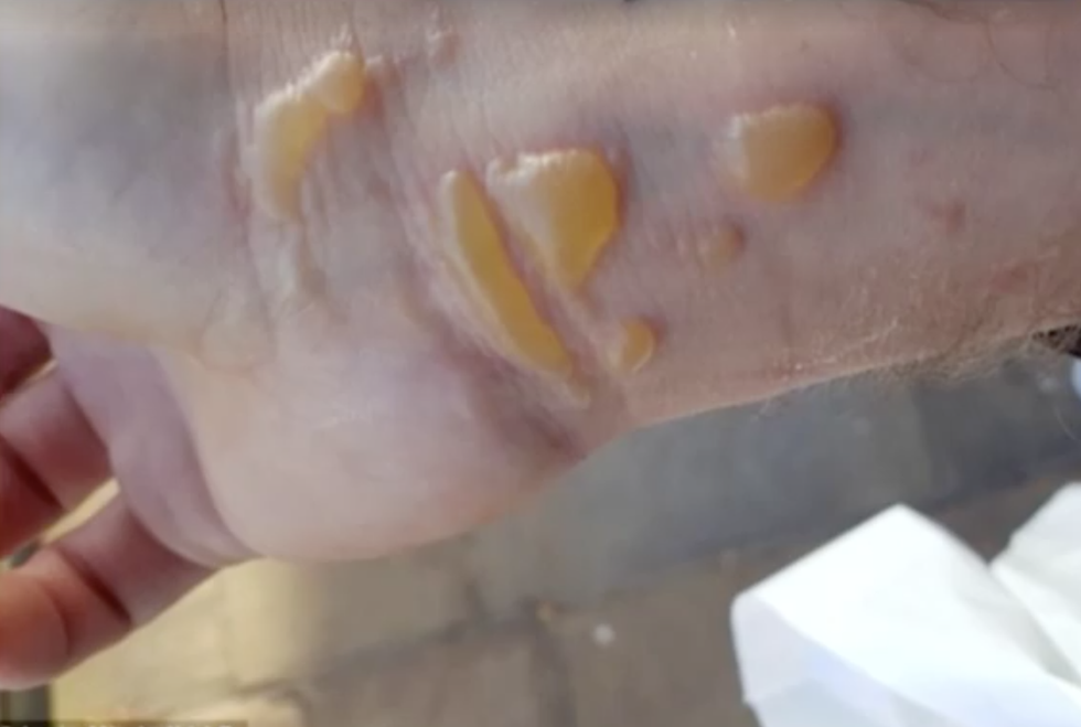 Skin, Hand, Finger, Jaw, Nail, 