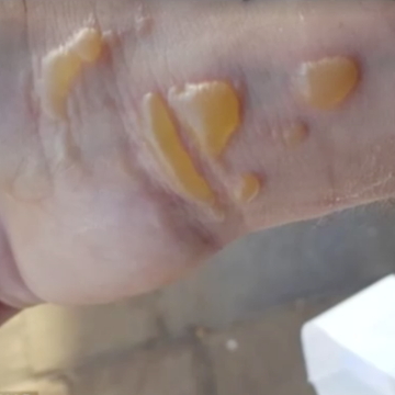 Hand, Finger, Jaw, Nail, 