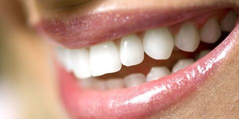 Tooth, Jaw, Lip, Mouth, Facial expression, Smile, Skin, Organ, Close-up, Cheek, 