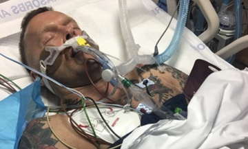 Medical procedure, Medical equipment, Oxygen mask, Medical, Patient, Service, 