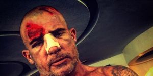 Dominic Purcell shows the injury he received on Prison Break set
