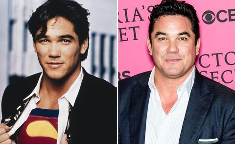 Dean Cain Then And Now