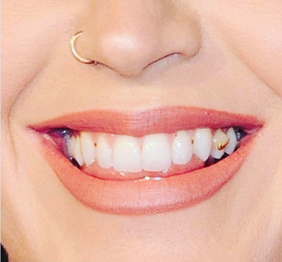 katy perry diamond teeth
