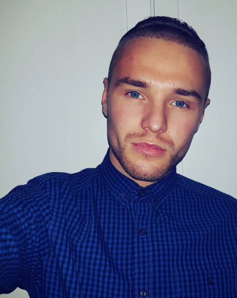 X Factor finalist shares gruesome video of hair transplant and you can't help but look X Factor finalist shares gruesome video of hair transplant and you can't help but look