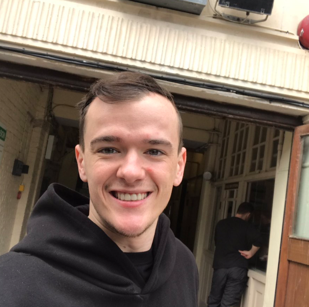 Bgt S George Sampson Gets Hair Transplant Aged 23