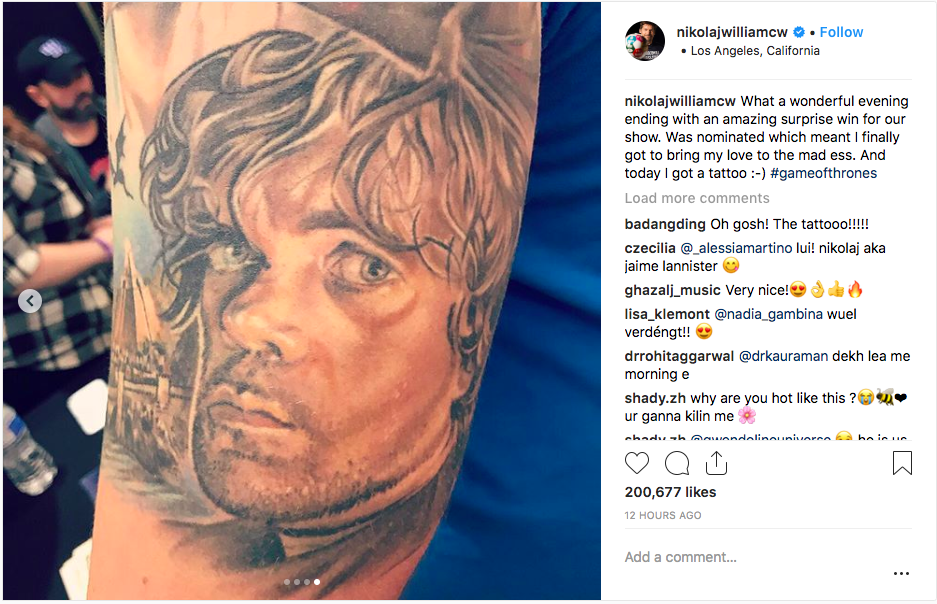 Is Pete Davidson removing his Kim Kardashian tattoos