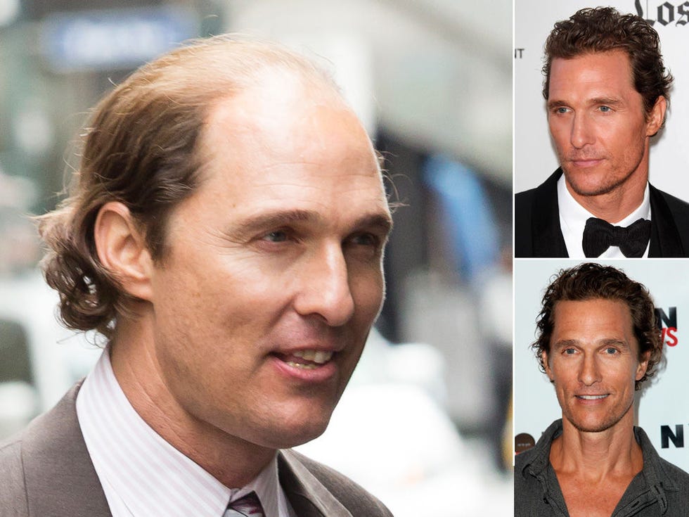 Nose, Ear, Lip, Cheek, Hairstyle, Chin, Forehead, Eyebrow, Collar, Dress shirt, 