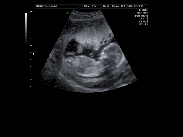 The Week Abortion Ban Bind The Week Abortion Ban Bind