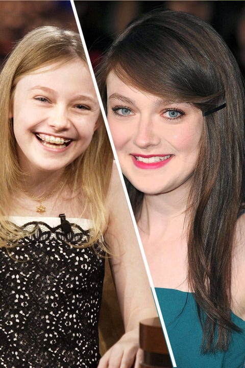 Famous Faces With Braces Faith Hill And More Celebrities Who Had Braces